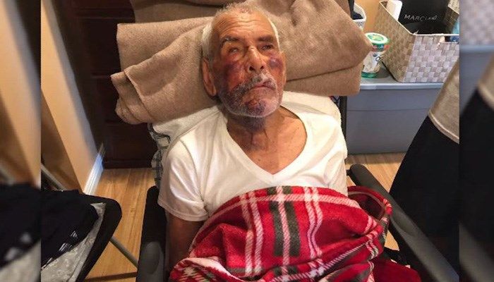 Rodolfo Rodriguez, 92, suffered a broken jaw, two broken ribs and broken cheek bones. (Source: CNN)